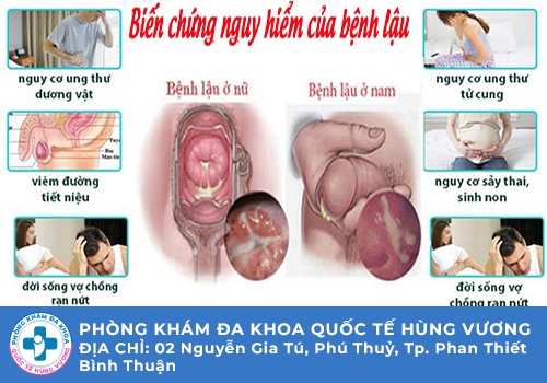 Tiểu buốt có mủ ở nam giới nguy hiểm như thế nào?