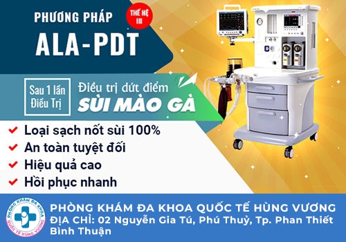 Kỹ thuật điều trị sùi mào gà