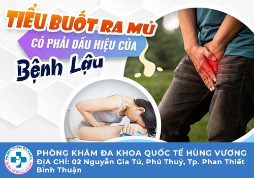 Tiểu buốt là triệu chứng của bệnh gì?