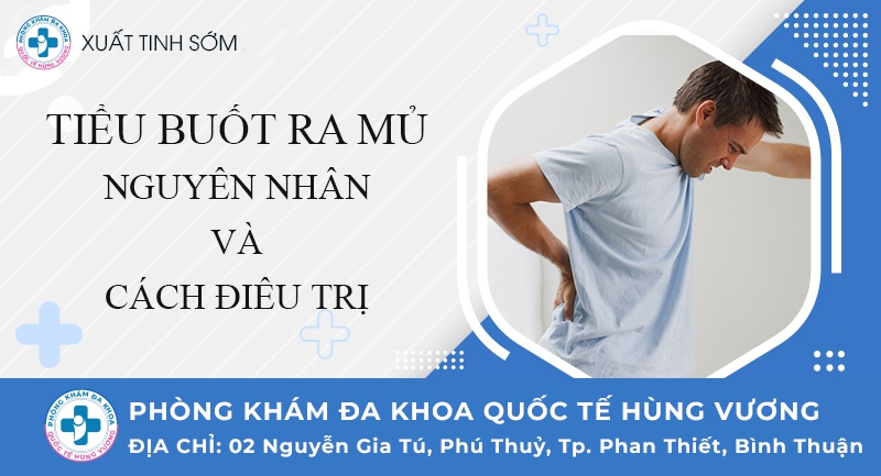 Tiểu buốt chảy mủ là bệnh gì?