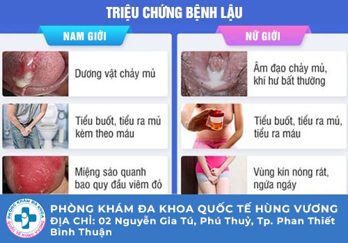 Đi tiểu buốt có mủ ở nam giới là bệnh gì?