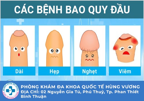 Những bệnh bao quy đầu thường gặp ở nam giới