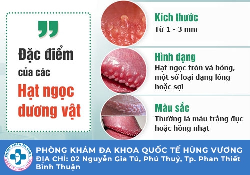 Dấu hiệu nhận biết chuỗi hạt ngọc dương vật là gì?