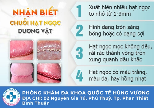 Hạt ngọc dương vật là gì?