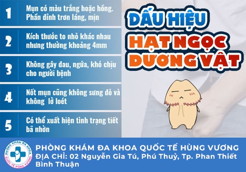 Dấu hiệu nhận biết chuỗi hạt ngọc dương vật là gì?
