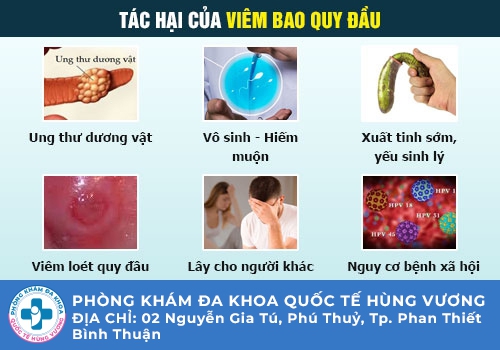 Những bệnh bao quy đầu thường gặp ở nam giới