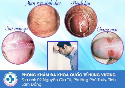 Các bệnh tình dục phổ biến