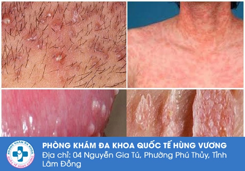 Các bệnh lý nguy hiểm nam giới cần đi điều trị sớm