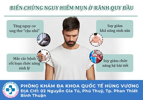 Chuỗi hạt ngọc dương vật có nguy hiểm không?