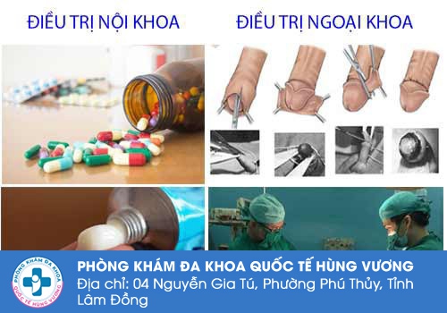 Phương pháp điều trị kết hợp giữa nội và ngoại khoa