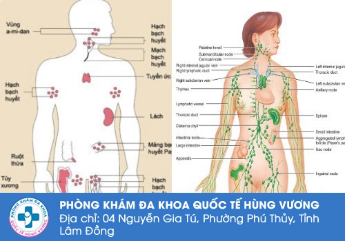 Nổi hạch ở bẹn có nguy hiểm không