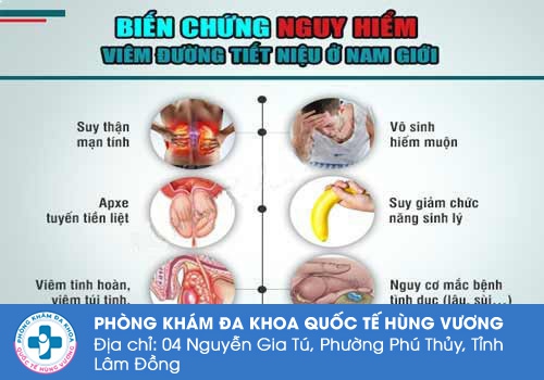 Bệnh đường tiết niệu để lại rất nhiều hệ lụy, trong đó vô sinh là một trong số đó