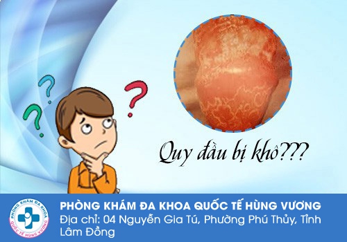 Quy đầu bị khô là do đâu