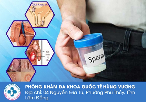 Các nguyên nhân dẫn đến nam giới bị tinh trùng loãng