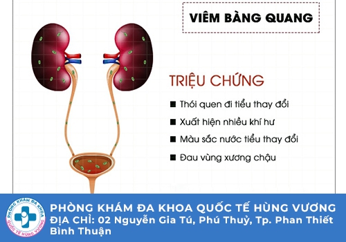 Triệu chứng viêm bàng quang