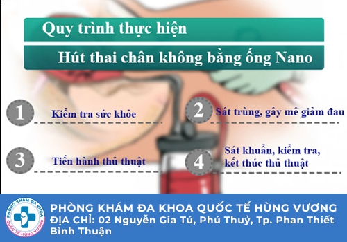 Phá thai ngoại khoa