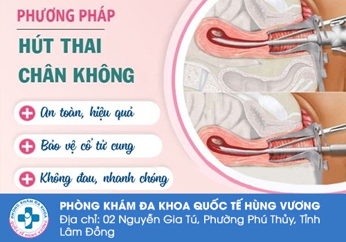 Phá thai 16 tuần bằng phương pháp hút thai chân không.