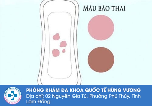 Màu sắc của máu báo thai.