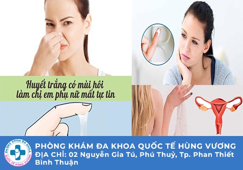 Nguyên nhân huyết trắng có mùi hôi là gì?