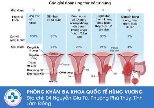 Nổi mụn cứng vùng kín không đau ở nữ giới là bệnh gì?