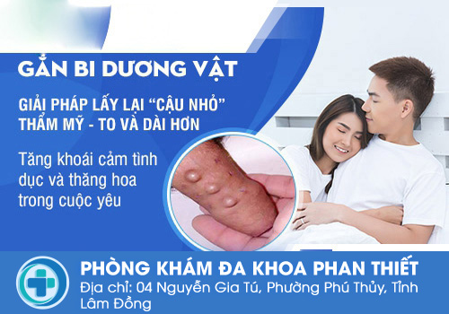 Những lưu ý khi gắn bi dương vật là gì?