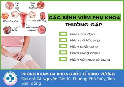 Khi nào nên đi khám phụ khoa?