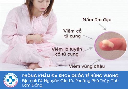 Lợi ích khám phụ khoa