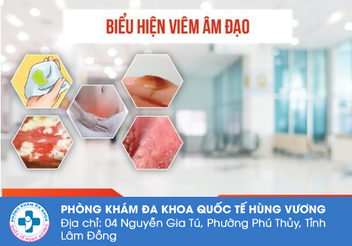 Mọc mụn nước âm đạo viêm phụ khoa