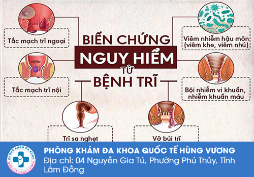 Bệnh trĩ có nguy hiểm không?