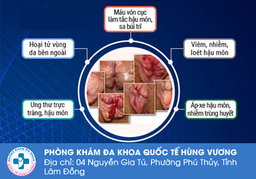 Triệu chứng đi cầu ra máu tươi nhiều có nguy hiểm không?