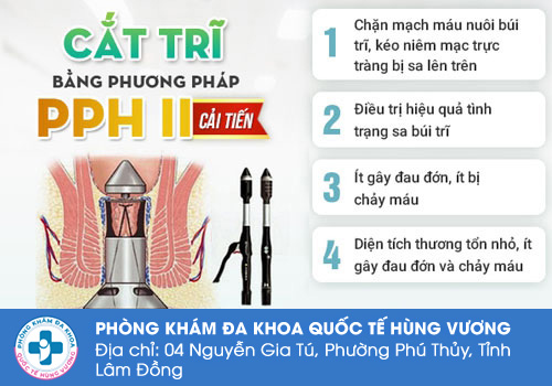  Phẫu thuật trĩ bằng phương pháp PPH-II