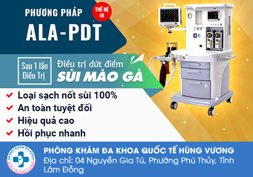 Cách chữa sùi mào gà ở miệng hiệu quả