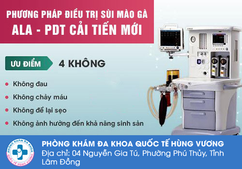 Sùi mào gà ở lưỡi điều trị như thế nào?