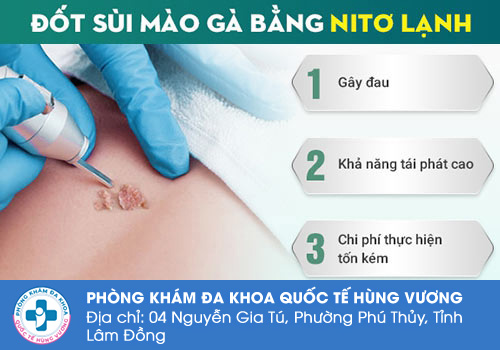 Điều trị sùi mào gà ở vùng kín bằng phương pháp đốt điện, đốt laser, áp lạnh