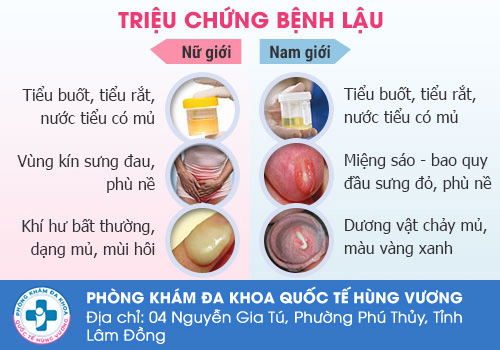 Tiểu buốt ra mủ là gì?