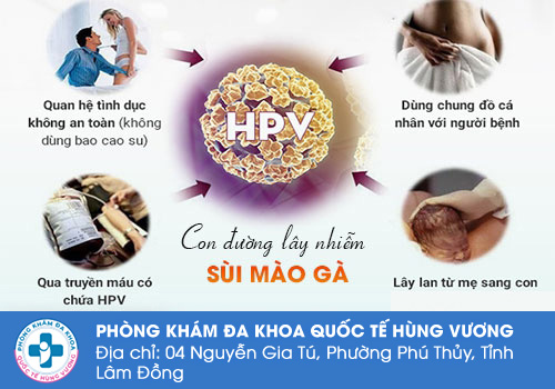 Nguyên nhân gây bệnh sùi mào gà ở vùng kín nữ giới là gì?