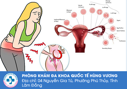 Thống kinh là gì?