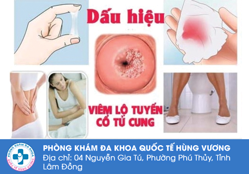 Các bệnh vùng kín nữ giới thường gặp phải 