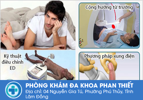 Phương pháp điều trị liệt dương hiệu quả