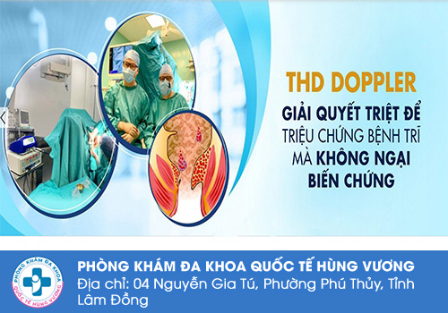Chữa trĩ bằng phương pháp treo mạch THD không phẫu thuật