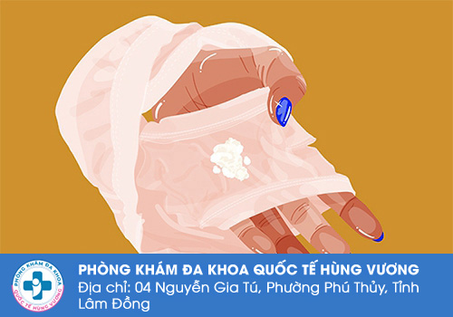 Nguyên nhân gây ra hiện tượng dịch âm đạo trắng sữa