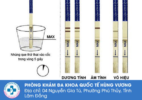 Xét nghiệm nước tiểu kiểm tra thai