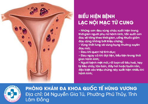 Các bệnh vùng kín nữ giới thường gặp phải