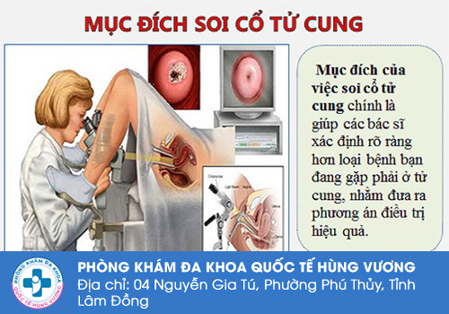 Mục đích của việc soi cổ tử cung
