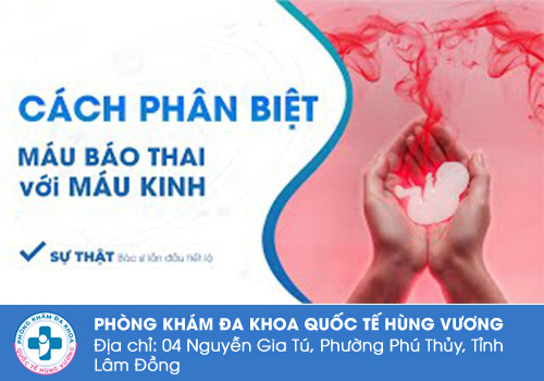 Máu báo thai màu gì?