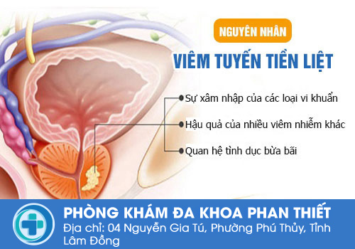 Nguyên nhân gây ra bệnh viêm tuyến tiền liệt