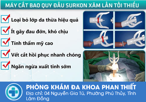 Phương pháp cắt bao quy đầu bằng kỹ thuật xâm lấn tối thiểu