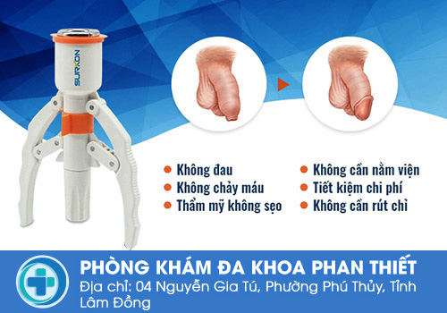 phương pháp cắt bao quy đầu bằng công nghệ Châu Âu