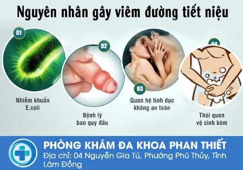 Nguyên nhân viêm đường tiết niệu ở nam giới