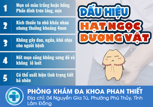 Triệu chứng chuỗi hạt ngọc dương vật
